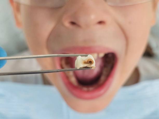 Best Emergency Tooth Extraction  in Virginia, MN